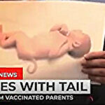 ワクチン接種した両親から尻尾や複数手足のある遺伝性疾患を持った胎児が生まれる