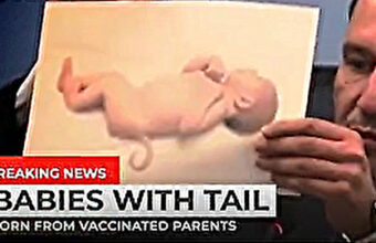 ワクチン接種した両親から尻尾や複数手足のある遺伝性疾患を持った胎児が生まれる
